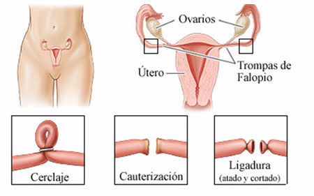 Metodo ligar mujeres duplex sexo Menorca-60214